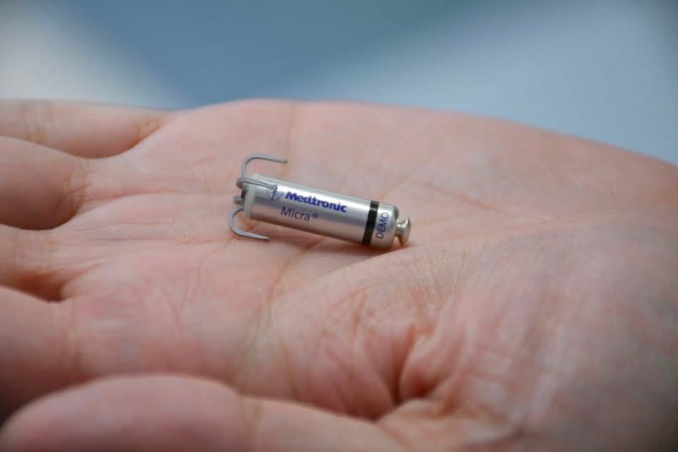 Implantación de marcapasos inalámbrico en el ISSSTE de Culiacán