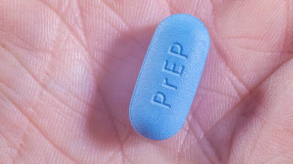 Salud Sexual | En la prevención del VIH, ¿el PrEP sustituye al condón? IMSS responde