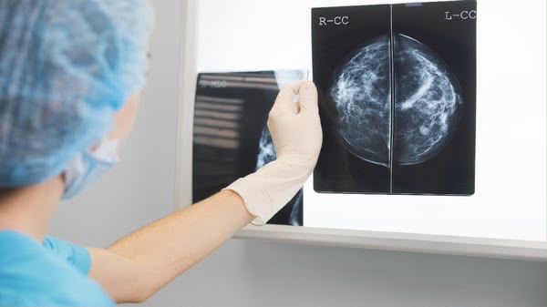 Estudios para detectar a tiempo el cáncer de mama