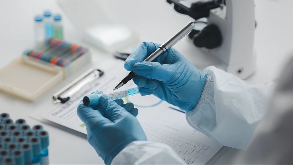 Peste neumónica. Análisis de laboratorio