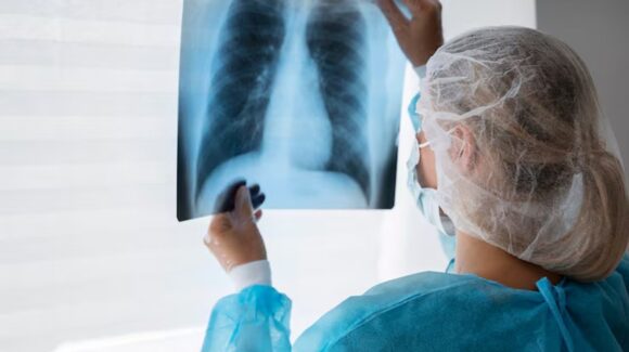Se sospecha peste neumónica: Rusia pone bajo cuarentena hospitales en Siberia tras muerte de científica