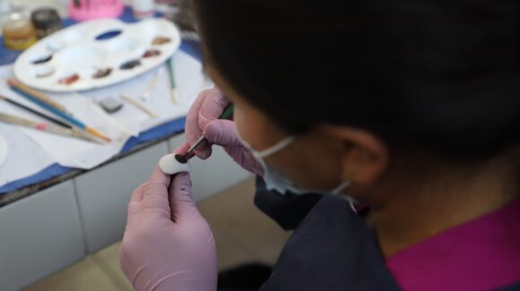 ¿Necesitas una prótesis ocular? DIF Mazatlán, Sinaloa anuncia campaña gratuita en noviembre